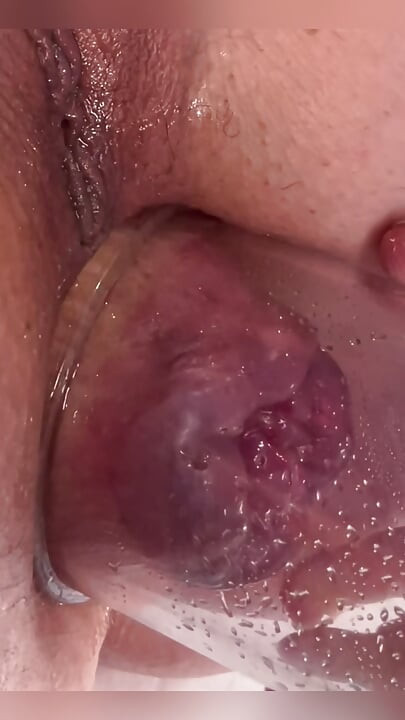 Extreme Anal Vacuum Pump Training 2025