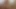 LizzyYum december 24 2023 my vibes Post Op Orgasm Pussy Masturbation Teasing