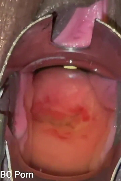 Spreading My Pussy Pissing Closeup