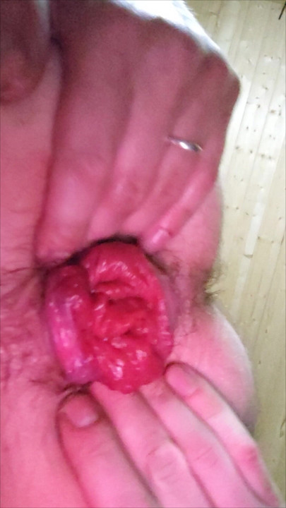 Anal close-up