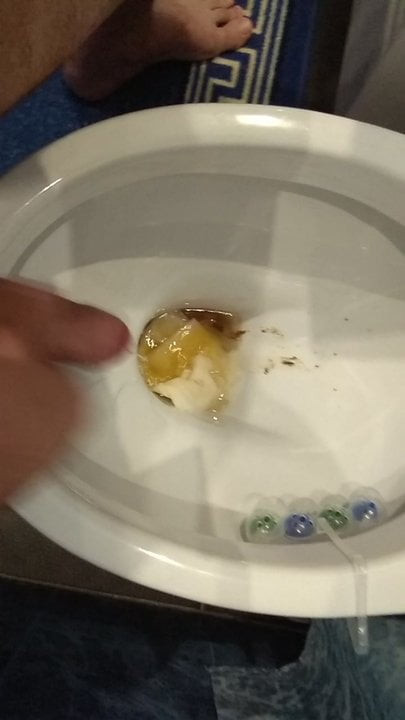 Sperm