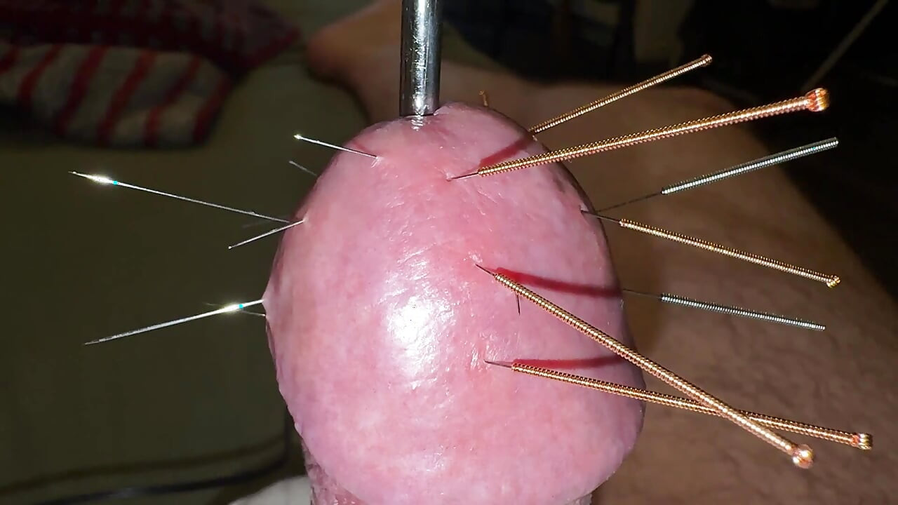 Acupuncture - Orgasm!