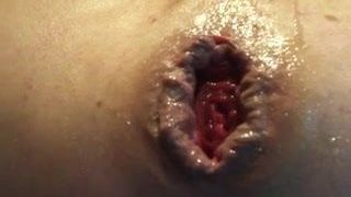Man-kut gapende verzakking anaal gat uitgerekt lul