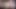 Close Up Condom Cumshot In Your Face