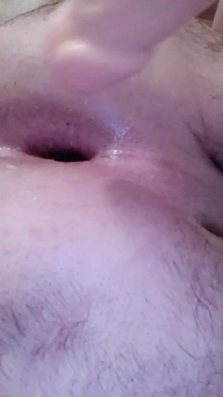 anal