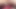 Crazy Anal Exam Gaping Farting Dildo Fuck with Huge Cum