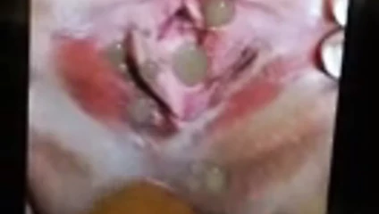 Lindzi 3