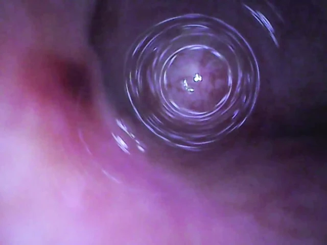 Fiberscope in urethral test tube