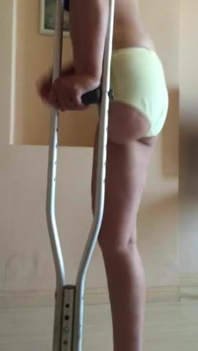 Pretty amputee girl