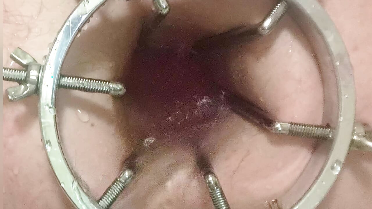 관장, 애널 샤워. 후장 거울을 통한 클로즈업 보기. 애널 섹스 물로 애널 채우기