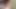 Appalachian dani siyah yarak oral tedavi gözden geçirildi