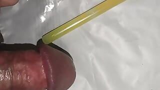 Σωλήνας στην ουρήθρα