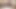 Kahverengi göz teaser