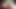 Foreskin movement (slowmotion) 455