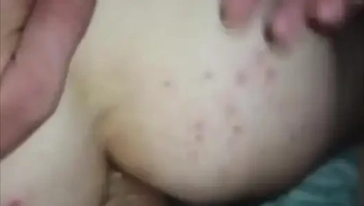 Vaginaler und analer Ausfluss zur Liebe