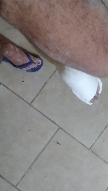 With foot in plaster, dick out