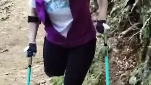 大自然中的截肢者我