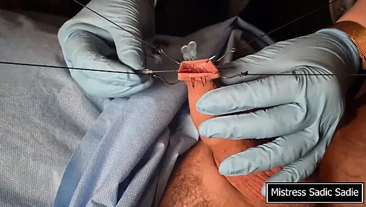 İğneler BDT'nin en iyi hali!