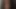 Beni duş alırken izle, iyileştiğini duydum