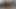 Lizzy Yum VR JULY 2023 JUST #31 post op orgasm pussy masturbation teasing