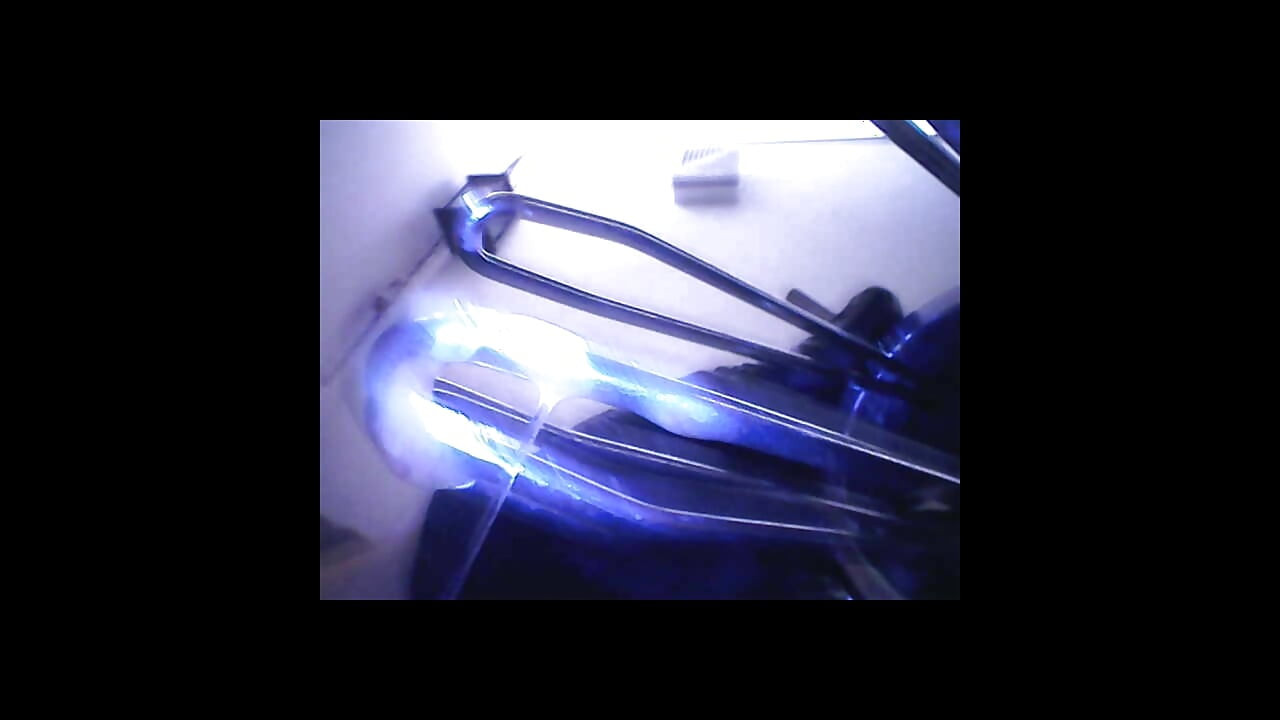 Spéculum et microcamera pour Lady Soniac