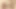 Why is my penis so small?