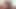 Bbcの毎日の投与量＃02