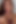 Stephi Staar: pop his top POV