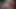 $clov aptal stajyerler hasta lola lynn'i okşar, onu muayene etmez!