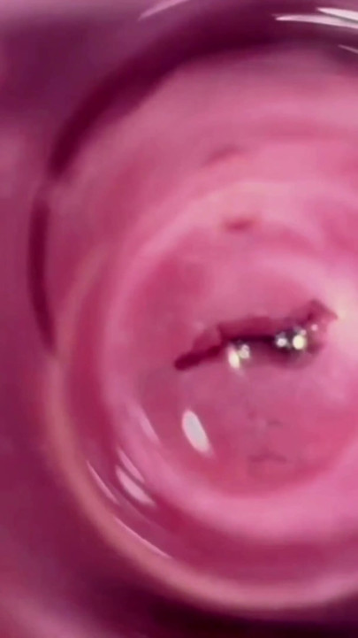 SUPER CLOSE UP - this is what the inside of the vagina looks like | Clip 2