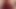 Selfbondage Mistake