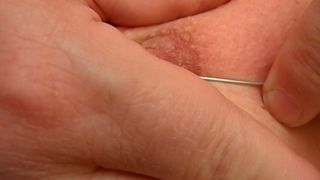 Pincho largo y agujas de acupuntura