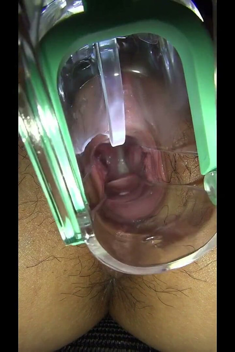Vaginal Observation Video 1