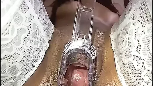 Polys gaping pussy speculum show