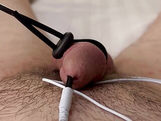 チンポ電極で前立腺に衝撃を与える