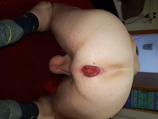 Pump porn video – Ass playing with prolapse