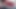 Teaser!!!