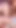 Jaw-dropping moment from "Alice in Consentland: Resisting Medical Narratives and Reclaiming Our Sexy Bodies -Cliff Media"