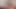 Micro penis and My Tiny Ballsack Play!