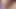 Monster Hairy Pussy Masturbation Huge Clitoris