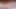 My cum tries to push out my sounding rod