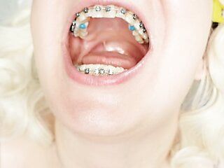 braces fetish: close up video mukbang