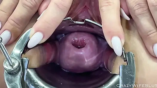 Glasdildo Gebärmutterhals penetration