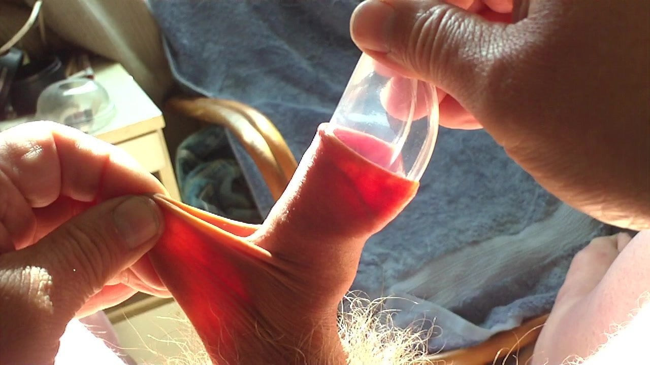 Stretch foreskin and scrotum in sunlight