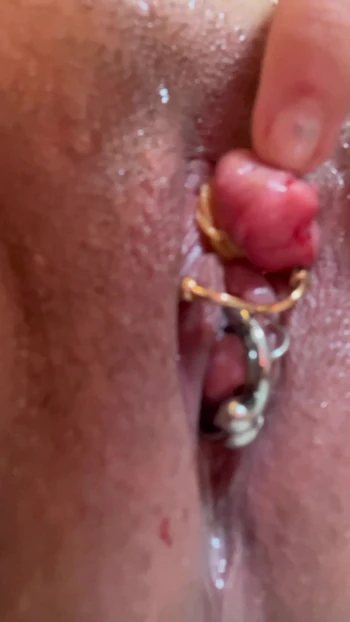 Enlarged clitoris bind