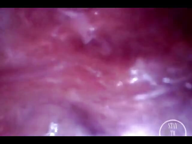 POV extrem tiefe anal erkundung! Schneller sichtbarer herzschlag