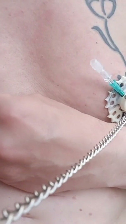 6 needles through the nipples stretched by plastic flower ring with holes on the terrace outside | Clip 1