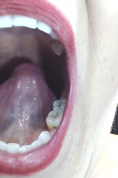 Inside My Big Mouth Tongue Teeth Uvula