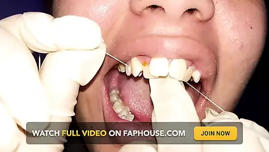 Versuche, Zahnseide zu verwenden (Nahaufnahme)