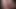 Mein Penis - Vorhaut, Foreskin, Cum, Closeup 5